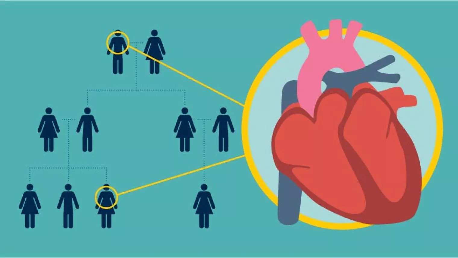 5 Penyakit Jantung Turunan yang Perlu Diwaspadai