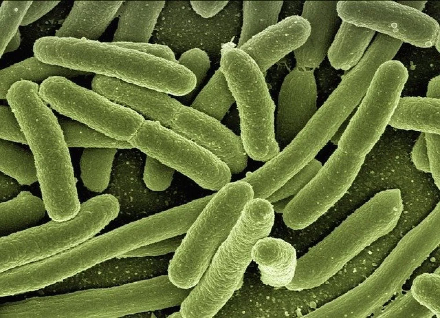 Kenali 3 Jenis Bakteri Penyebab Keracunan Makanan dan Cara Mengatasinya