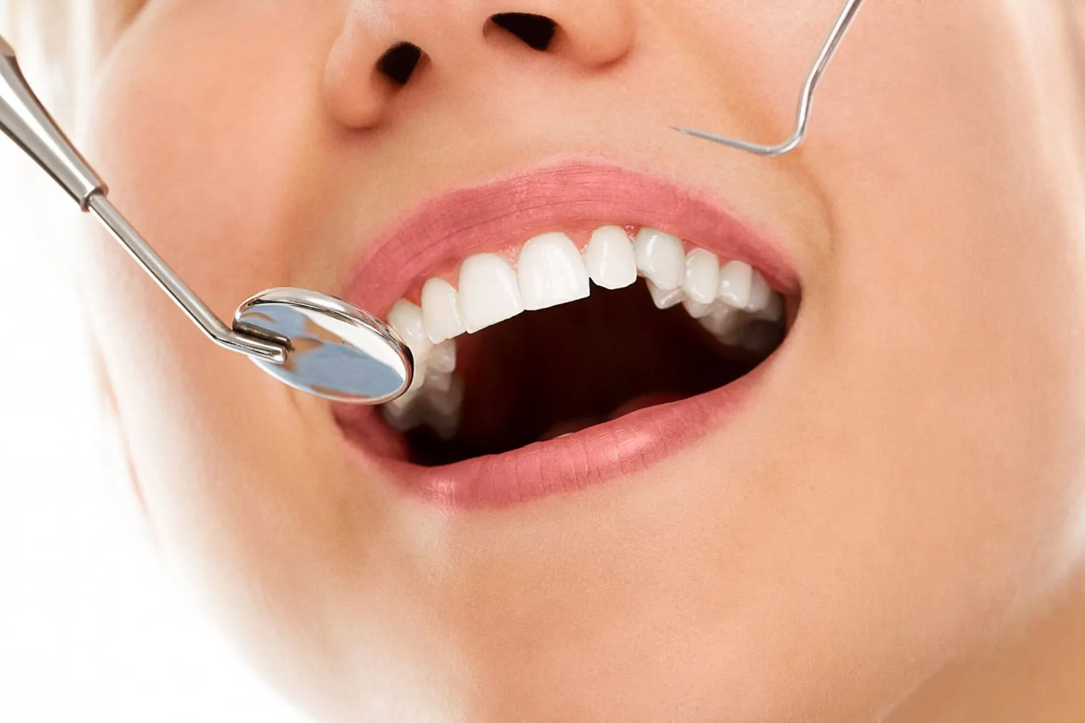 Jenis Treatment yang Dapat Membantu Merapihkan Gigi