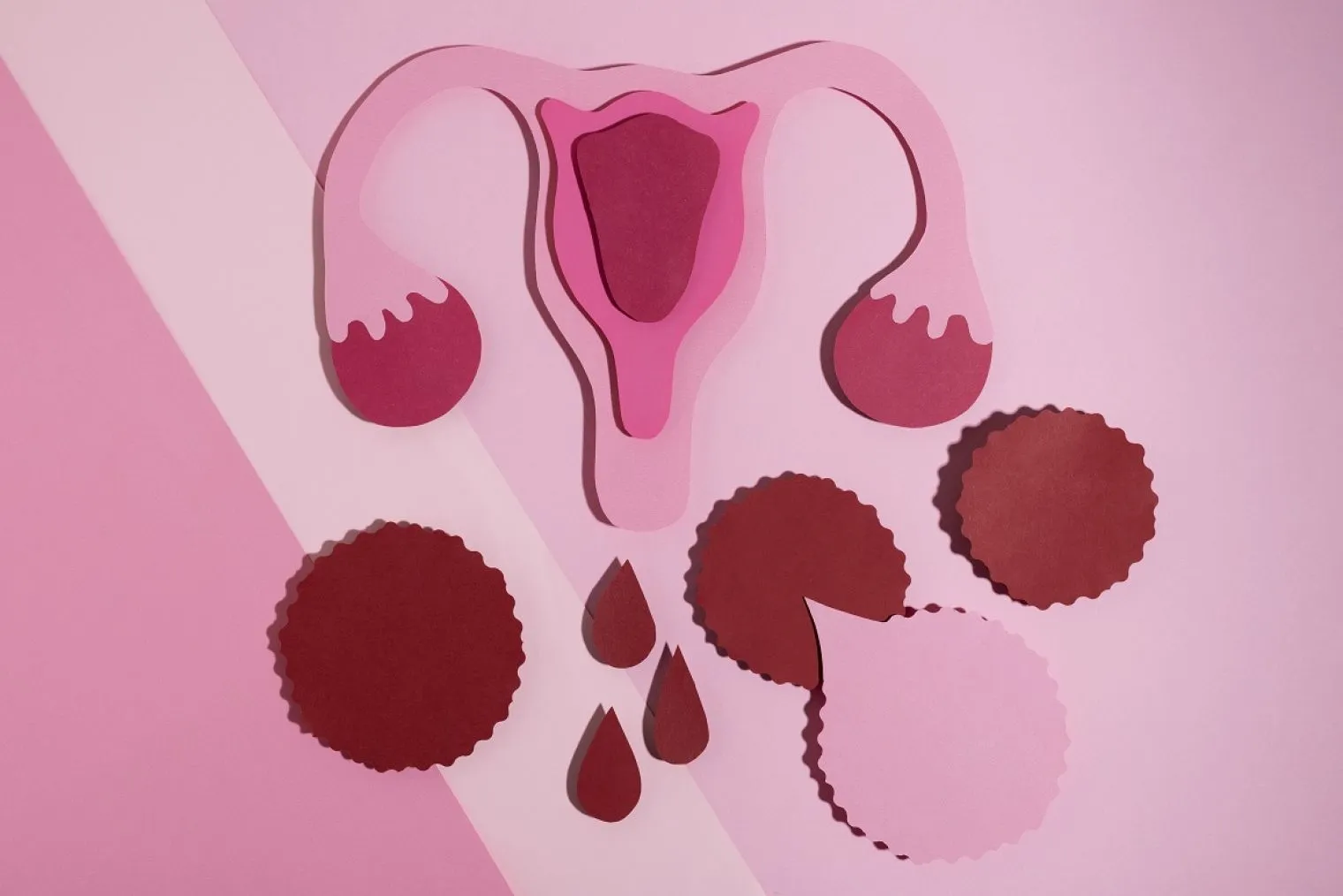 Endometrial Hyperplasia Penyebab Pendarahan Berat