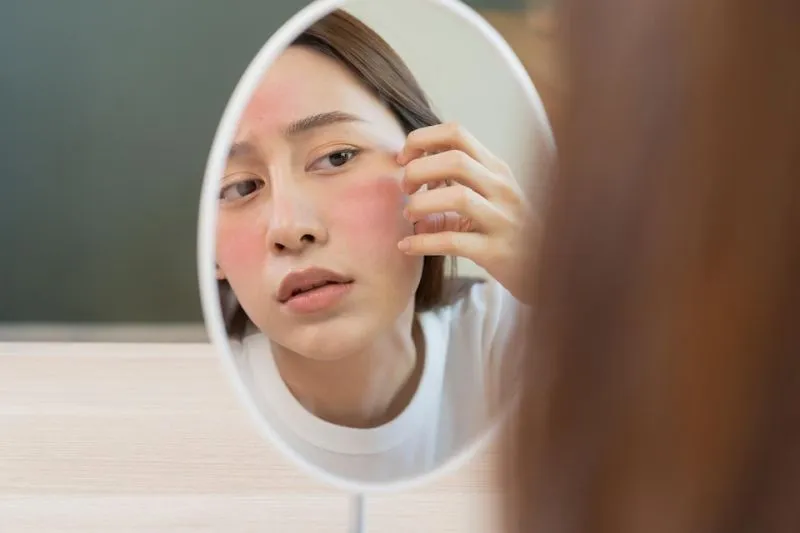 Hal yang Perlu Dihindari saat Memakai Skincare untuk Kulit Sensitif