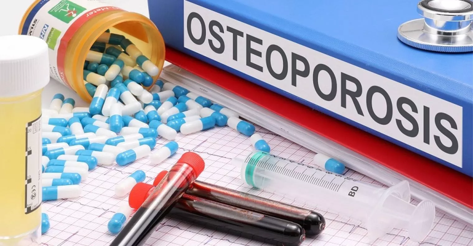 Mengenal Osteoporosis: Bagaimana Kondisinya di Indonesia?