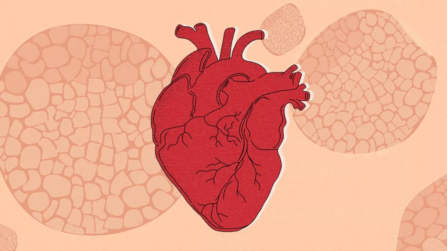 Waspadai Penyakit Jantung: Jenis, Gejala, Resiko