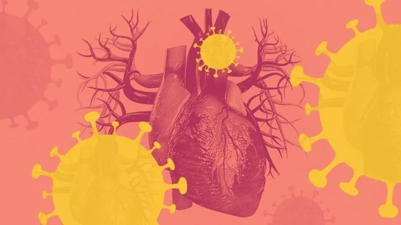 Apakah COVID-19 Bisa Meningkatkan Risiko Penyakit Jantung?